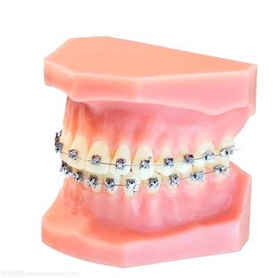 Les appareils dentaires fixes d'appareils orthodontiques mettent à niveau les supports de fil souple