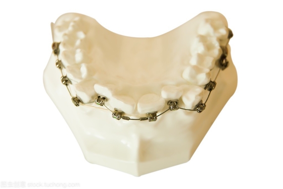 Supports dentaires Orthodontie Outils de modélisation de dents fixes Appareils dentaires