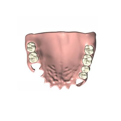 Le haut laboratoire dentaire de mastication CFAO de dentier d'efficacité a fixé le dentier partiel