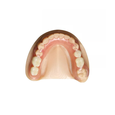 Laboratoire dentaire professionnel de dentier démontable dentaire de couronne de zircone d'OEM