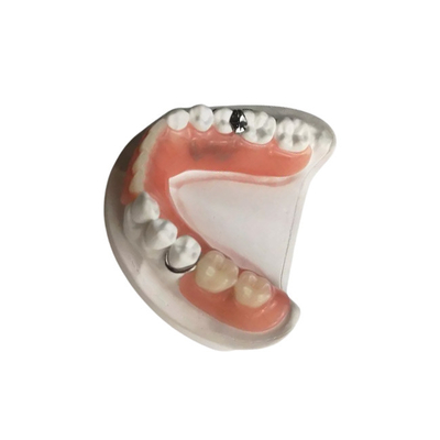 3D a imprimé les dentiers démontables faits sur commande dentaires de garantie de la qualité de couronne de zircone