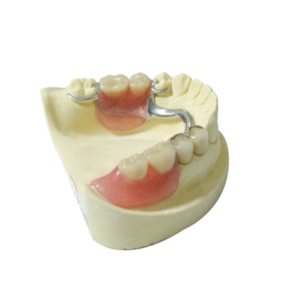 Dentiers partiels démontables de matériaux de laboratoire dentaire sain de dentier faits sur commande