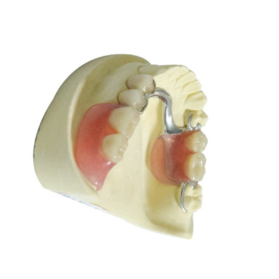 Dentiers partiels démontables acryliques de produits dentaires professionnels de laboratoire