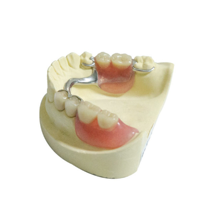 Dentiers partiels démontables en plastique de laboratoire de la CE de rechange dentaires de produits