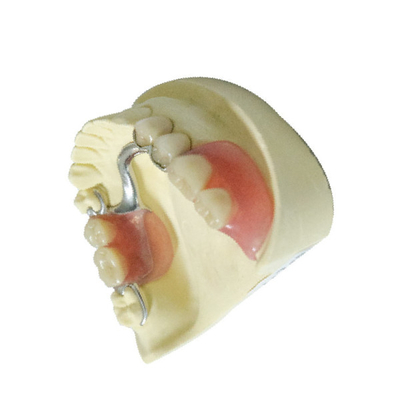 Dentiers partiels démontables de laboratoire de polymère dentaire fait sur commande de produits