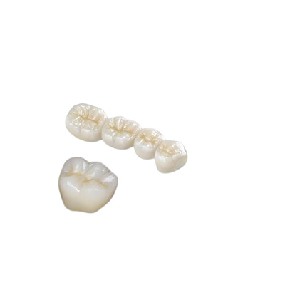 Résistance à la corrosion forte haut Biocompatibility de zircone de couronne dentaire de dent