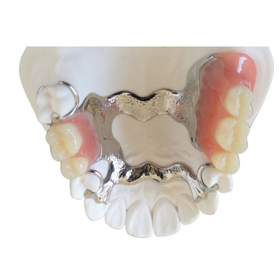 Pont dentaire haut Intermiscibility biologique en couronne de l'imprimante PFM d'OEM 3D