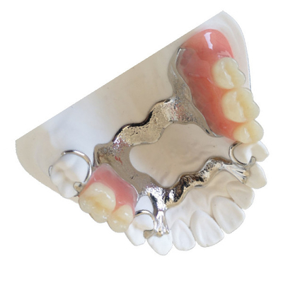 Porcelaine dentaire dentaire de FDA de couronne du laboratoire PFM fondue à la couronne en métal