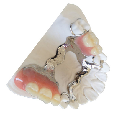 Couronne adaptée aux besoins du client 3D de dent de PFM imprimant le pont dentaire de PFM