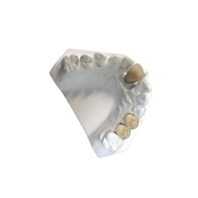 Couronne en céramique de haute résistance du laboratoire dentaire PFM de couronne de porcelaine d'or jaune