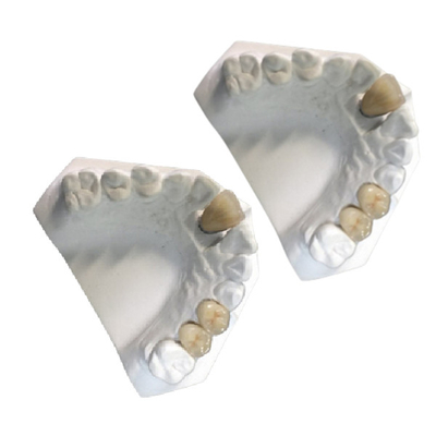 Couronne dentaire de porcelaine du Co-Cr PFM de couronne de porcelaine d'or jaune de laboratoire