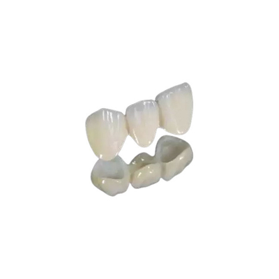 Couronne fixe finie simple de pont correctement de pont dentaire convenable en couronne