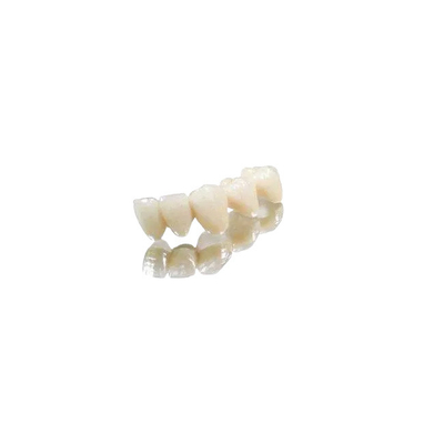 D'ajustement couronne correctement et couronne en métal de chrome de cobalt de dents de pont pleine