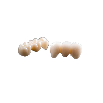 Le double a fini les dents fixes de pont en couronne d'alliage d'or de couronne de pont
