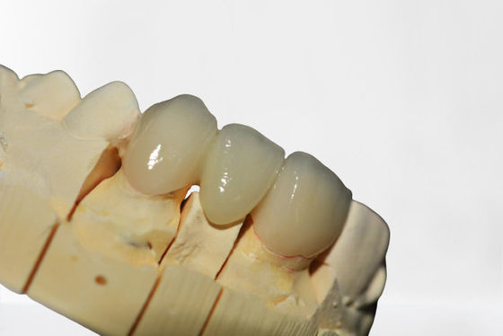 Propre de haute qualité de pont dentaire en couronne de bonne stabilité et rangé propres et rangés