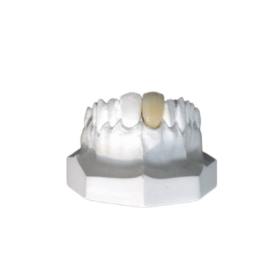 Les couronnes adaptées aux besoins du client de porcelaine ont un vrai aspect et une couleur naturelle