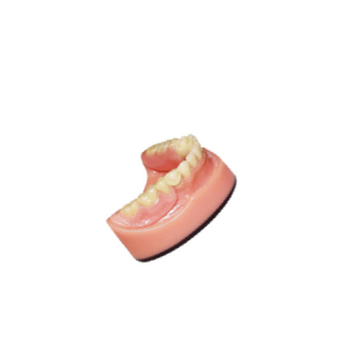 Système de balayage intraoral dentaire dentaire de représentation du pont 3D Digital du laboratoire PFM de dentier