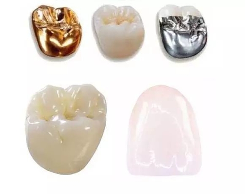 Bonnes couronnes et ponts dentaires de Biocompatibility non faciles de porter l'écurie de couleur