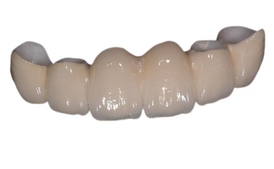 Couronne dentaire de porcelaine extérieure lisse reconstituer mâcher la bonne stabilité de puissance