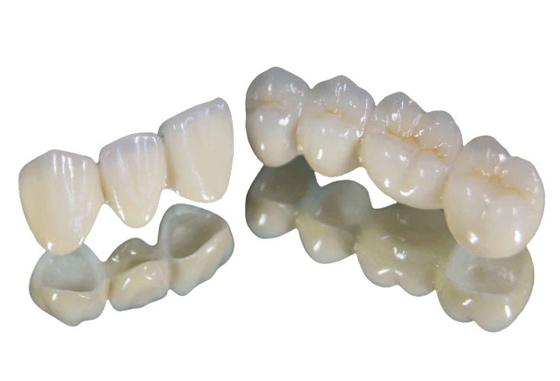 Écurie forte de couleur de résistance à l'usure de couronne de dent de porcelaine de haute qualité