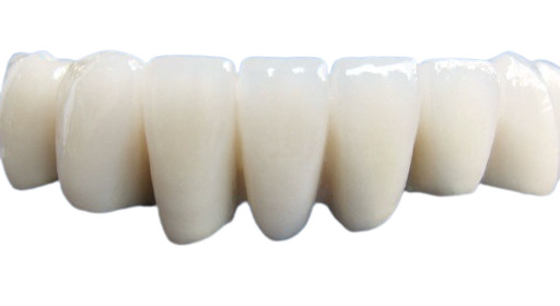 Couronne dentaire de belle porcelaine non facile de porter la résistance d'acide et d'alcali