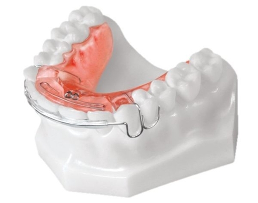 Les appareils orthodontiques dentaires simples installent le matériel biologique de technologie