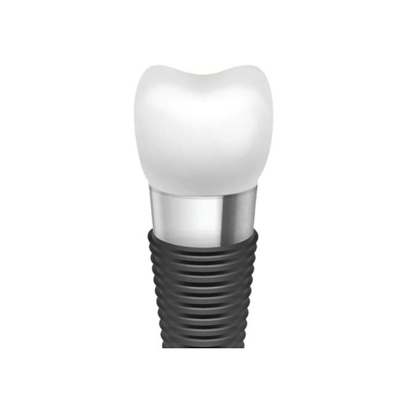 Longévité et fonctionnalité supérieures des barres d'implant dentaire