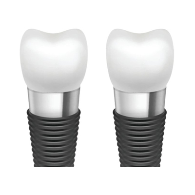 Amélioration de l'esthétique orale avec des barres d'implant dentaire