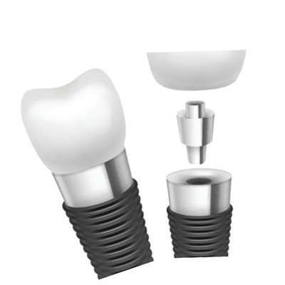 L'implant dentaire barre l'innovation matérielle pour la représentation supérieure
