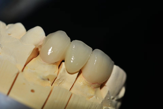 Laboratoire dentaire sur mesure pour les prothèses dentaires en zirconium - Livraison rapide et réparation