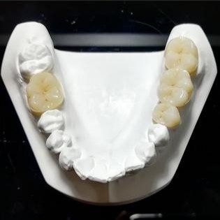 Qualité constante les couronnes de Mark Of Our Ceramic Dental
