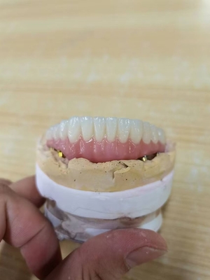 Élevant des normes notre garantie de la qualité de couronne d'implant dentaire