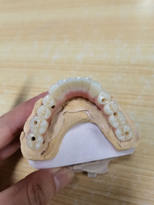 Élevant des normes notre garantie de la qualité de couronne d'implant dentaire