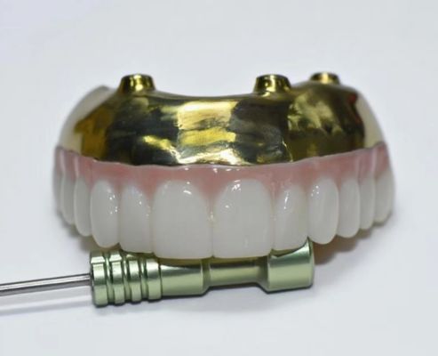 Pont en zirconium complet avec support de barre de titane, couronnes en zirconium avec ponts avec support de barre de titane