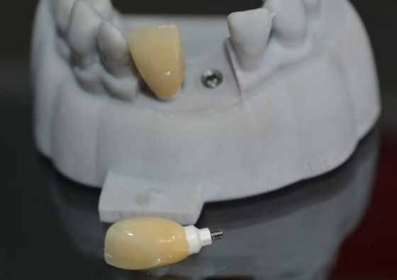 Cad PEEK, support personnalisé