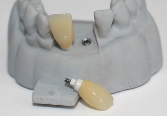 Cad PEEK, support personnalisé