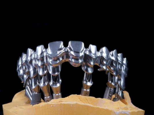 FDA 3014652903 forts fortement esthétiques dentaires de pont de PFM extrêmement