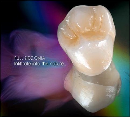 Onlay dentaire de marqueterie de placage de couronne de zircone Tout-en céramique de FDA 3014652903