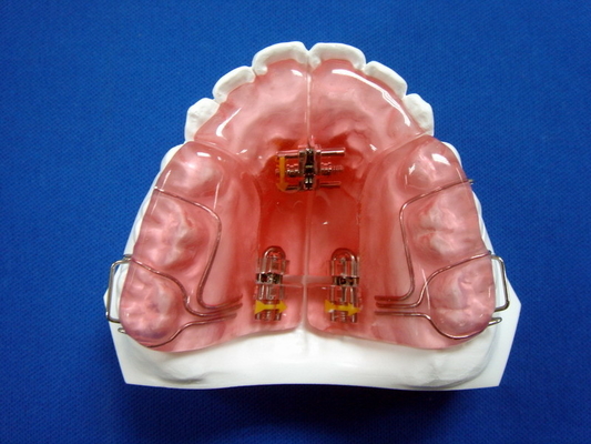 L'OEM démontable fait sur commande a fixé la bonne longévité d'appareils orthodontiques