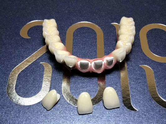 La couronne biocompatible extérieure lisse de dent de zircone facile maintiennent