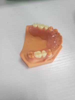 3D a imprimé des dentiers pour les laboratoires dentaires basés sur des données numériques