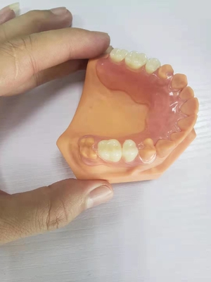 3D a imprimé des dentiers pour les laboratoires dentaires basés sur des données numériques
