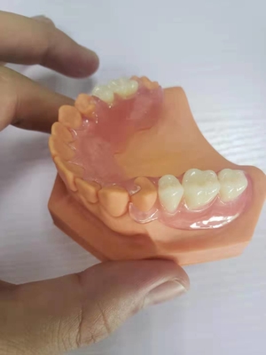 3D a imprimé des dentiers pour les laboratoires dentaires basés sur des données numériques