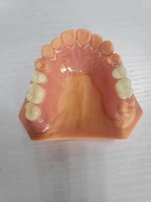 3D a imprimé des dentiers pour les laboratoires dentaires basés sur des données numériques