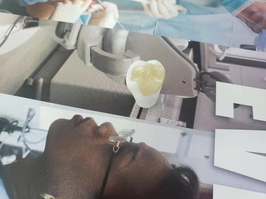 Onlay dentaire Tout-en céramique durable de marqueterie de placage de couronne de FDA semblable