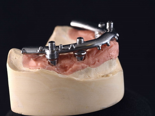 L'implant titanique de la commande numérique par ordinateur All-On-4 a fixé des dentiers pour la clinique dentaire