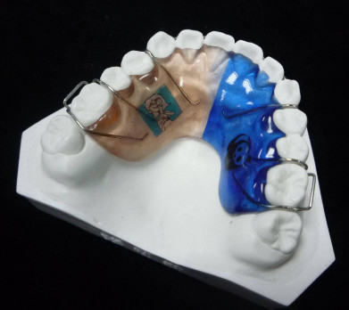 Fil orthodontique de réparation réglable d'appareils de longévité élevée