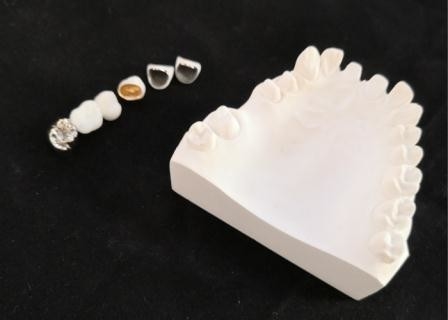 Résistance à la corrosion adaptée aux besoins du client en métal dentaire de couronne de porcelaine de PFM plein