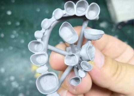 Résistance à la corrosion adaptée aux besoins du client en métal dentaire de couronne de porcelaine de PFM plein
