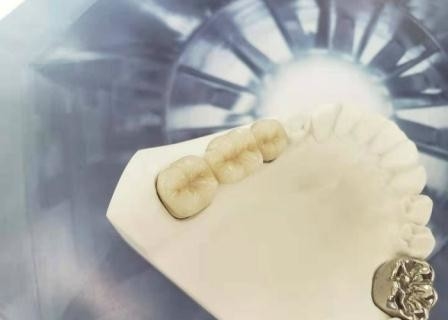 Couronne dentaire de polissage haut Intermiscibility biologique de porcelaine d'OEM